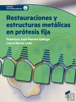 Bertrand.pt - Restauraciones Y Estructuras Metálicas En Prótesis Fija