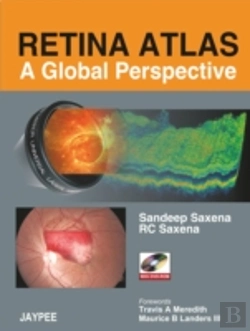 Bertrand.pt - Retina Atlas - A Global Perspective
