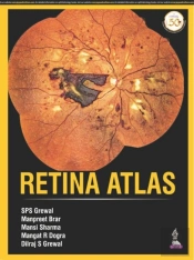 Retina Atlas