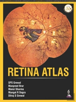 Bertrand.pt - Retina Atlas
