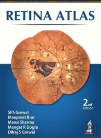Retina Atlas