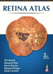 Retina Atlas