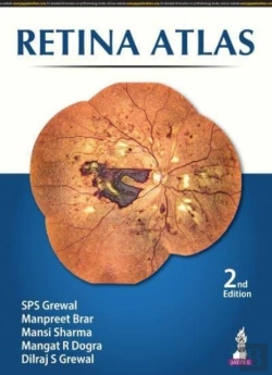 Bertrand.pt - Retina Atlas