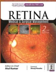 Retina