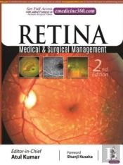 Retina