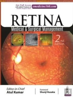 Bertrand.pt - Retina
