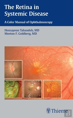 Bertrand.pt - Retina In Systemic Disease