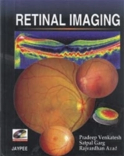 Bertrand.pt - Retinal Imaging