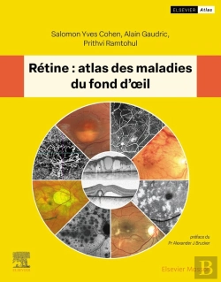 Bertrand.pt - Rétine: Atlas Des Maladies Du Fond D'Oeil