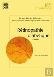 Rétinopathie Diabétique (2e Édition)