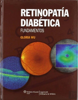 Bertrand.pt - Retinopatía Diabética