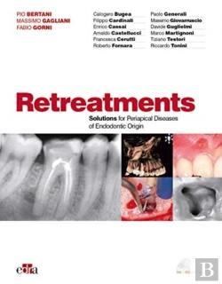 Bertrand.pt - Retreatment. Solutions For Apical Diseases Of Endodontic Origin