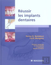 Réussir Les Implants Dentaires