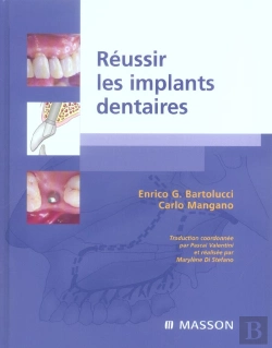 Bertrand.pt - Réussir Les Implants Dentaires