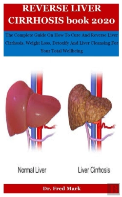Bertrand.pt - Reverse Liver Cirrhosis Book 2020