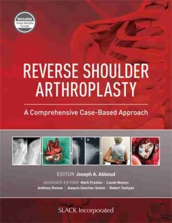 Bertrand.pt - Reverse Shoulder Arthroplasty