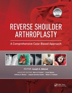 Bertrand.pt - Reverse Shoulder Arthroplasty
