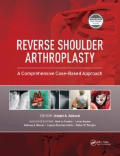 Reverse Shoulder Arthroplasty