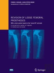 Revision Of Loose Femoral Prostheses With A Stem System Based On The ''Press-Fit'' Principle