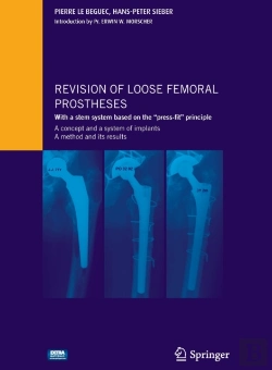 Bertrand.pt - Revision Of Loose Femoral Prostheses With A Stem System Based On The 