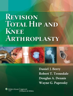 Bertrand.pt - Revision Total Hip And Knee Arthroplasty