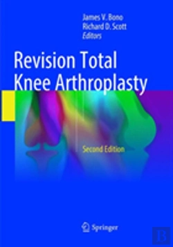 Bertrand.pt - Revision Total Knee Arthroplasty