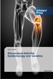 Rheumatoid Arthritis: Epidemiology And G