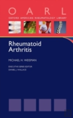 Bertrand.pt - Rheumatoid Arthritis