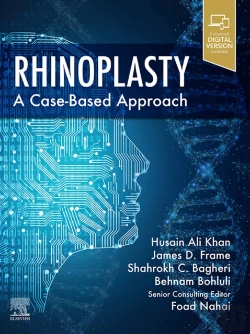 Bertrand.pt - Rhinoplasty E-Book