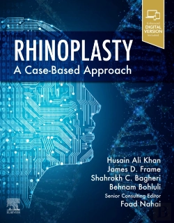 Bertrand.pt - Rhinoplasty
