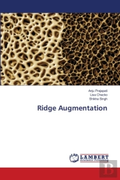 Ridge Augmentation