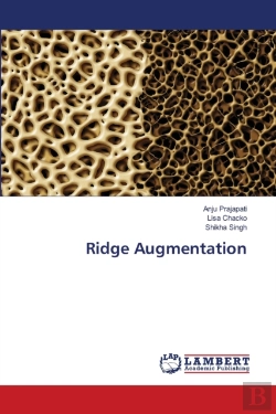 Bertrand.pt - Ridge Augmentation