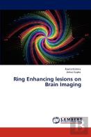 Ring Enhancing Lesions On Brain Imaging