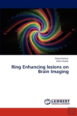 Bertrand.pt - Ring Enhancing Lesions On Brain Imaging