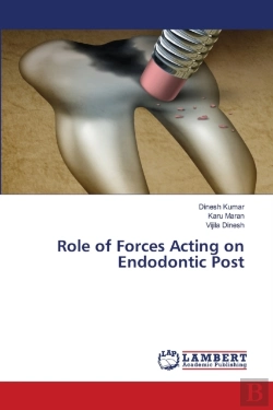 Bertrand.pt - Role Of Forces Acting On Endodontic Post