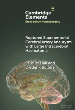 Bertrand.pt - Ruptured Supratentorial Cerebral Artery Aneurysm With Large Intracerebral Haematoma