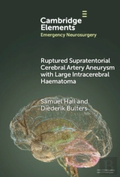 Ruptured Supratentorial Cerebral Artery Aneurysm With Large Intracerebral Haematoma