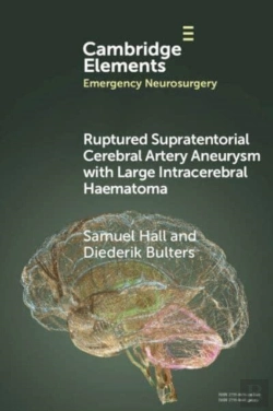 Bertrand.pt - Ruptured Supratentorial Cerebral Artery Aneurysm With Large Intracerebral Haematoma