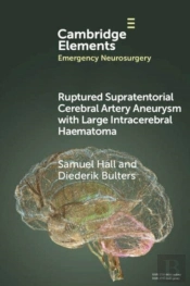 Ruptured Supratentorial Cerebral Artery Aneurysm With Large Intracerebral Haematoma