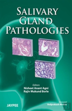 Bertrand.pt - Salivary Gland Pathologies