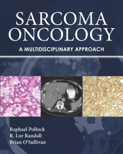 Bertrand.pt - Sarcoma Oncology