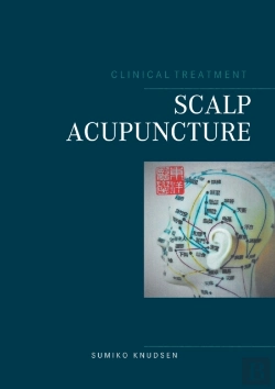 Bertrand.pt - Scalp Acupuncture