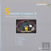 Scanner A Rayon X ; Tomodensitometrie