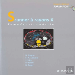 Bertrand.pt - Scanner A Rayon X ; Tomodensitometrie