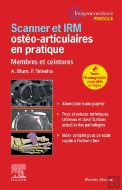 Bertrand.pt - Scanner Et Irm Osteo-Articulaires En Pratique