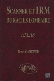 Scanner Irm Rachis Lomb.Atlas