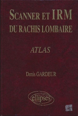 Bertrand.pt - Scanner Irm Rachis Lomb.Atlas