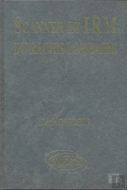 Bertrand.pt - Scanner Irm Rachis Lomb.Texte
