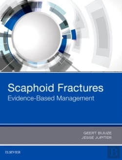Bertrand.pt - Scaphoid Fractures: Evidence-Based Management