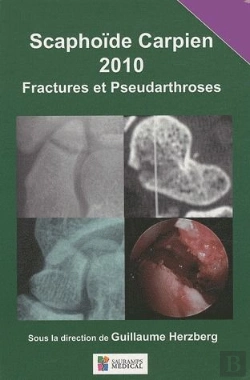 Bertrand.pt - Scaphoïde Carpien ; Fractures Et Pseudoarthroses (Édition 2010)